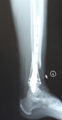 Nigel Holland X-Ray